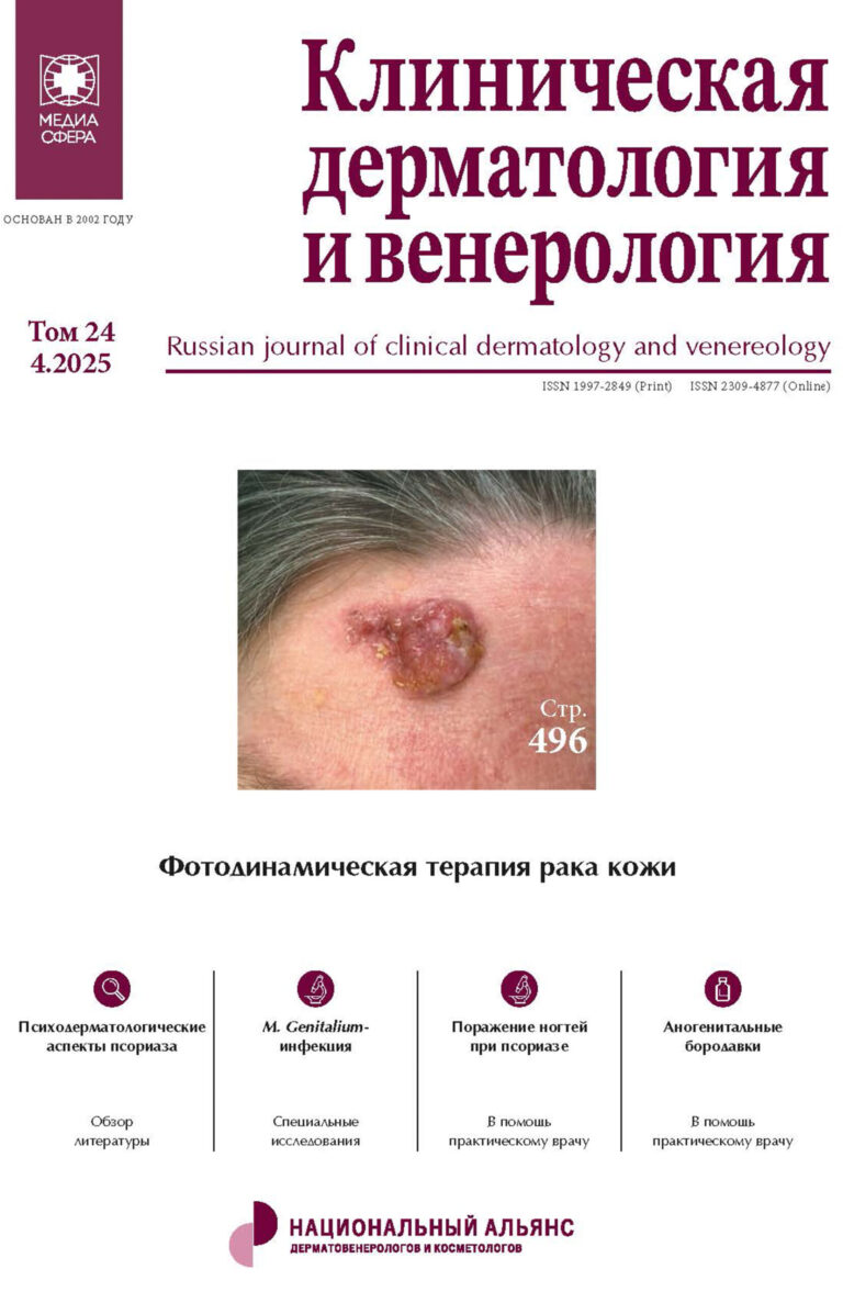Возможности применения гиалуроновой кислоты и полимолочной кислоты в лечении атрофических рубцовых изменений кожи